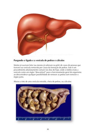 ! &*!
Purgando o fígado e a vesícula de pedras e cálculos
Muitos já ouviram falar (ou mesmo já sofreram na pele) de casos de pessoas que
tiveram sua vesícula removida por causa da formação de pedras. Este é um
procedimento absolutamente comum nos dias de hoje, onde o médico trata a
vesícula como um órgão “descartável” para o funcionamento geral do organismo
ao desconsiderar qualquer possibilidade de remover as pedras sem remover o
órgão junto.
Abaixo a foto de uma vesícula extraída, cheia de pedras, ou cálculos:
 