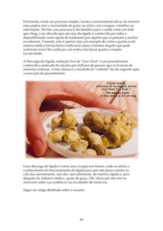 ! &#!
Felizmente, existe um processo simples, barato e extremamente eficaz de remover
estas pedras sem a necessidade de gastar ou sofrer com cirurgias, remédios ou
internações. De fato, este processo é tão benéfico para a saúde como um todo
que chega a ser absurdo que não seja divulgado e conhecido por todos e
disponibilizado como opção de tratamento por aqueles que se prestam a auxiliar
os enfermos. Contudo, este é apenas mais um exemplo de como a ganância do
sistema médico-farmacêutico tradicional afasta o homem daquilo que pode
realmente trazer-lhe saúde por um motivo tão banal quanto a simples
lucratividade.
A Descarga do Fígado, tradução livre de “Liver Flush” é um procedimento
conhecido e praticado há séculos por milhares de pessoas que se livraram de
inúmeros sintomas. A foto abaixo é o resultado da “colheita” do dia seguinte após
a execução do procedimento:
Uma descarga de fígado é como uma cirurgia sem bisturi, onde se utiliza o
conhecimento do funcionamento do fígado para que este possa vomitar os
cálculos normalmente, sem dor, sem sofrimento, de maneira rápida e, para
desgosto da indústria médica, quase de graça. Oh, talvez por isto nem se
mencione sobre sua existência nas faculdades de medicina.
Segue um artigo detalhado sobre o assunto:
 
