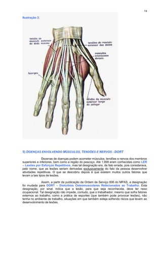 14
Ilustração 3:
5) DOENÇAS ENVOLVENDO MÚSCULOS, TENDÕES E NERVOS - DORT
Dezenas de doenças podem acometer músculos, tendões e nervos dos membros
superiores e inferiores, bem como a região do pescoço. Até 1.998 eram conhecidas como LER
– Lesões por Esforços Repetitivos, mas tal designação era, de fato errada, pois considerava,
pelo nome, que as lesões seriam derivadas exclusivamente do fato da pessoa desenvolver
atividades repetitivas. O que se descobriu depois é que existem muitos outros fatores que
levam a tais tipos de lesões.
Assim, a partir da publicação da Ordem de Serviço 606 do MPAS, a designação
foi mudada para DORT – Distúrbios Osteomusculares Relacionados ao Trabalho. Esta
designação, por sinal, indica que a lesão, para que seja reconhecida, deve ter nexo
ocupacional. Tal designação não impede, contudo, que o trabalhador, mesmo que sofra fatores
externos ao trabalho, como a prática de esportes (que também pode provocar lesões), não
tenha no ambiente de trabalho, situações em que também esteja sofrendo riscos que levem ao
desenvolvimento de lesões.
 
