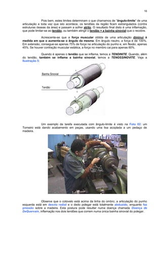 16
Pois bem, estes limites determinam o que chamamos de “ângulo-limite” de uma
articulação e toda vez que isto acontece, os tendões da região ficam estrangulados (contra
estruturas ósseas da área) e passam a sofrer atrito. O resultado final disto é uma inflamação,
que pode limitar-se ao tendão, ou também atingir o tendão + a bainha sinovial que o recobre.
Acrescente-se que a força muscular obtida de uma articulação diminui à
medida em que o aumenta-se o ângulo da mesma. Em ângulo neutro, a força é de 100%.
Em extensão, consegue-se apenas 75% de força na articulação do punho e, em flexão, apenas
45%. Se houver contração muscular estática, a força no membro cai para apenas 60%.
Quando é apenas o tendão que se inflama, temos a TENDINITE. Quando, além
do tendão, também se inflama a bainha sinovial, temos a TENOSSINOVITE. Veja a
Ilustração 5:
Bainha Sinovial
Tendão
Um exemplo de tarefa executada com ângulo-limite é visto na Foto 02: um
Torneiro está dando acabamento em peças, usando uma lixa acoplada a um pedaço de
madeira.
Observe que o cotovelo está acima da linha do ombro; a articulação do punho
esquerda está em desvio radial e o dedo polegar está totalmente abduzido, enquanto faz
pressão sobre a madeira. Esta postura pode resultar numa doença chamada Doença de
DeQuervain, inflamação nos dois tendões que correm numa única bainha sinovial do polegar.
 