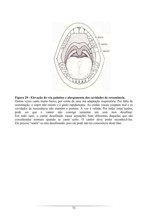 73
Figura 29 - Elevação do véu palatino e alargamento das cavidades de ressonância.
Outras vezes canta muito baixo, por conta de uma má adaptação respiratória. Por falta de
sustentação, o sopro não resiste e é gasto rapidamente. As cordas vocais coaptam mal e as
cavidades de ressonância não mantêm a postura. A voz é velada. Por todas estas razões,
pode ser que o cantor não consiga sustentar um som sem desafinar.
Em todo caso, o cantar desafinado causa sensações bem diferentes daquelas que são
consideradas normais quando se canta certo. O cantor deve poder reconhecê-las.
Ele precisa “sentir” se está desafinando, pois ele pode não ter consciência deste fato.
 