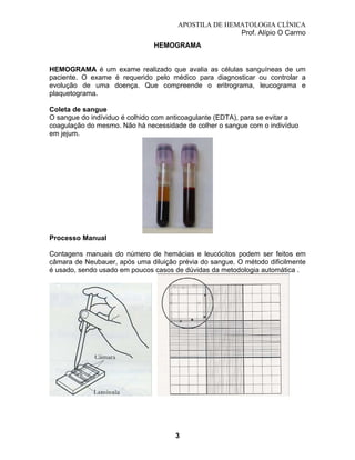 APOSTILA DE HEMATOLOGIA CLÍNICA
Prof. Alípio O Carmo
HEMOGRAMA

HEMOGRAMA é um exame realizado que avalia as células sanguíneas de um
paciente. O exame é requerido pelo médico para diagnosticar ou controlar a
evolução de uma doença. Que compreende o eritrograma, leucograma e
plaquetograma.
Coleta de sangue
O sangue do indíviduo é colhido com anticoagulante (EDTA), para se evitar a
coagulação do mesmo. Não há necessidade de colher o sangue com o indivíduo
em jejum.

Processo Manual
Contagens manuais do número de hemácias e leucócitos podem ser feitos em
câmara de Neubauer, após uma diluição prévia do sangue. O método dificilmente
é usado, sendo usado em poucos casos de dúvidas da metodologia automática .

3

 