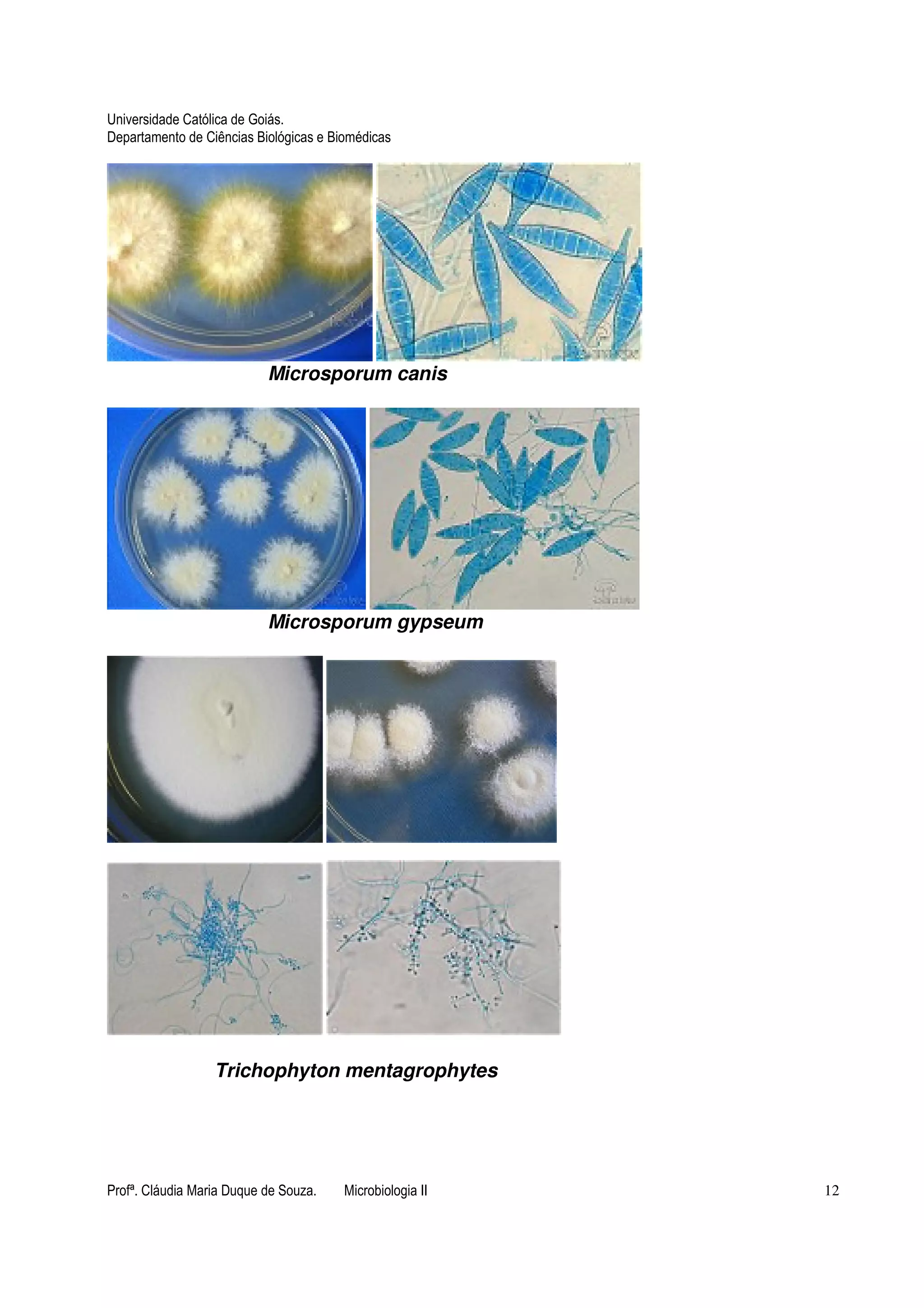 Universidade Católica de Goiás. 
Departamento de Ciências Biológicas e Biomédicas 
Microsporum canis 
Microsporum gypseum 
Trichophyton mentagrophytes 
Profª. Cláudia Maria Duque de Souza. Microbiologia II 12 
 