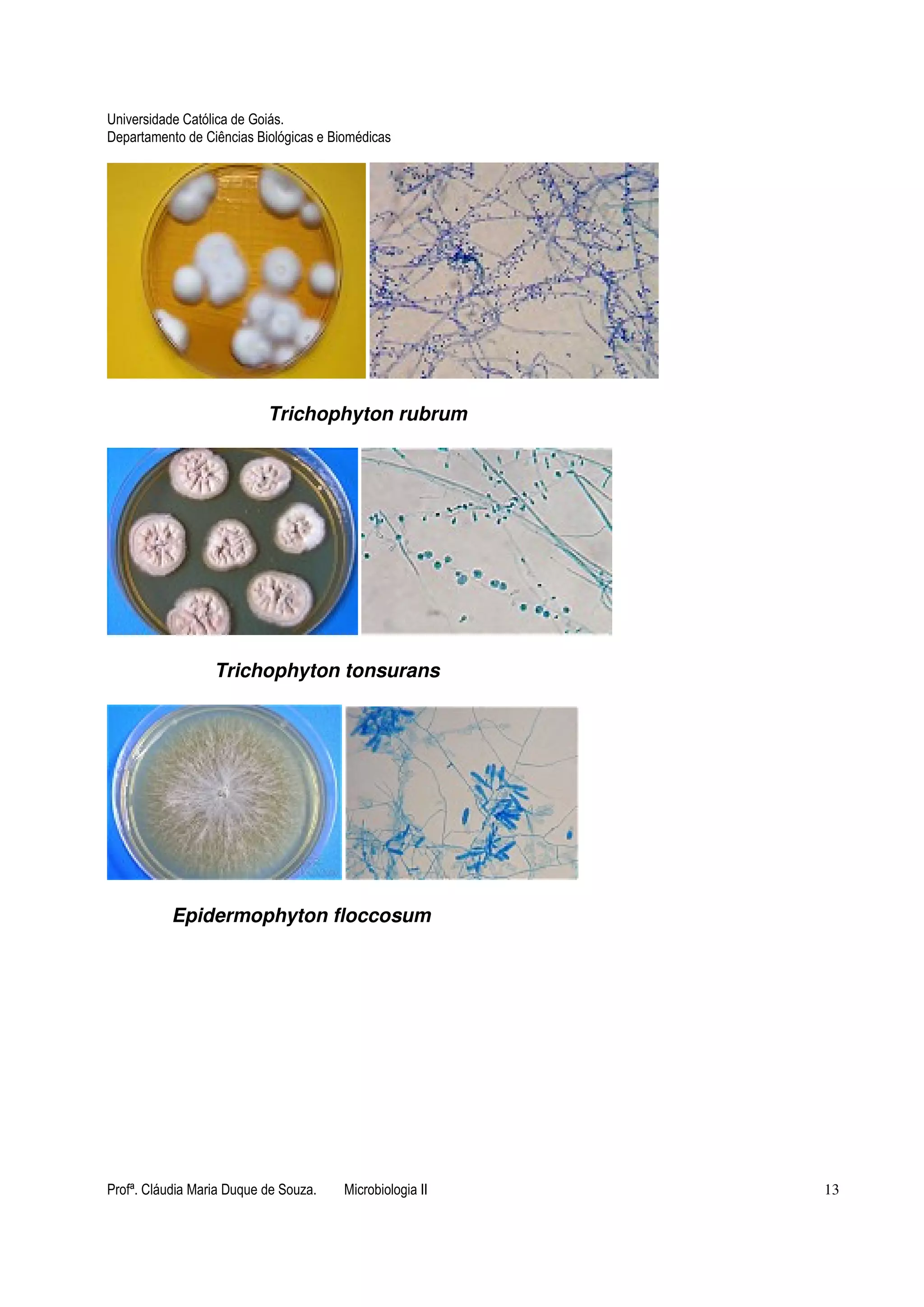 Universidade Católica de Goiás. 
Departamento de Ciências Biológicas e Biomédicas 
Trichophyton rubrum 
Trichophyton tonsurans 
Epidermophyton floccosum 
Profª. Cláudia Maria Duque de Souza. Microbiologia II 13 
 