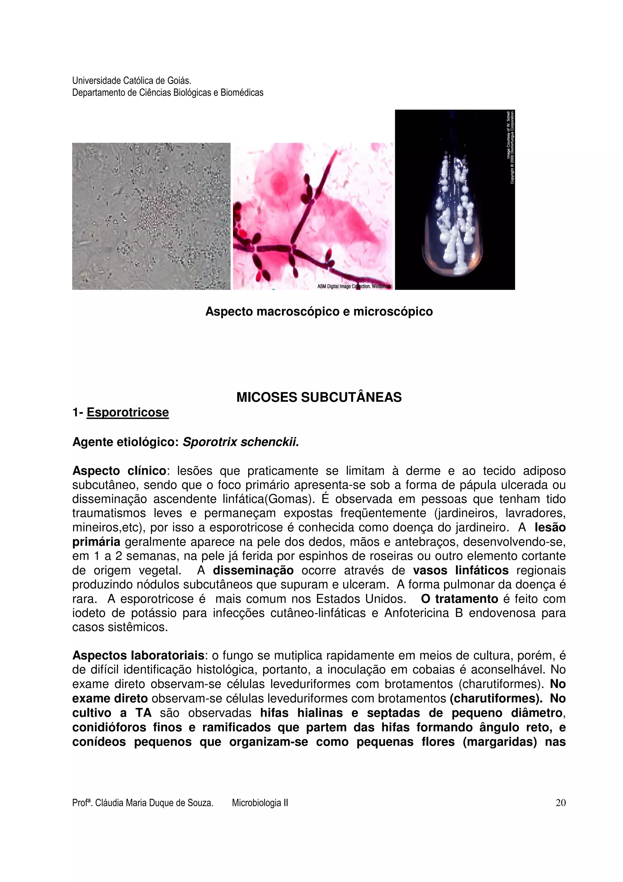 Universidade Católica de Goiás. 
Departamento de Ciências Biológicas e Biomédicas 
Aspecto macroscópico e microscópico 
MICOSES SUBCUTÂNEAS 
1- Esporotricose 
Agente etiológico: Sporotrix schenckii. 
Aspecto clínico: lesões que praticamente se limitam à derme e ao tecido adiposo 
subcutâneo, sendo que o foco primário apresenta-se sob a forma de pápula ulcerada ou 
disseminação ascendente linfática(Gomas). É observada em pessoas que tenham tido 
traumatismos leves e permaneçam expostas freqüentemente (jardineiros, lavradores, 
mineiros,etc), por isso a esporotricose é conhecida como doença do jardineiro. A lesão 
primária geralmente aparece na pele dos dedos, mãos e antebraços, desenvolvendo-se, 
em 1 a 2 semanas, na pele já ferida por espinhos de roseiras ou outro elemento cortante 
de origem vegetal. A disseminação ocorre através de vasos linfáticos regionais 
produzindo nódulos subcutâneos que supuram e ulceram. A forma pulmonar da doença é 
rara. A esporotricose é mais comum nos Estados Unidos. O tratamento é feito com 
iodeto de potássio para infecções cutâneo-linfáticas e Anfotericina B endovenosa para 
casos sistêmicos. 
Aspectos laboratoriais: o fungo se mutiplica rapidamente em meios de cultura, porém, é 
de difícil identificação histológica, portanto, a inoculação em cobaias é aconselhável. No 
exame direto observam-se células leveduriformes com brotamentos (charutiformes). No 
exame direto observam-se células leveduriformes com brotamentos (charutiformes). No 
cultivo a TA são observadas hifas hialinas e septadas de pequeno diâmetro, 
conidióforos finos e ramificados que partem das hifas formando ângulo reto, e 
conídeos pequenos que organizam-se como pequenas flores (margaridas) nas 
Profª. Cláudia Maria Duque de Souza. Microbiologia II 20 
 