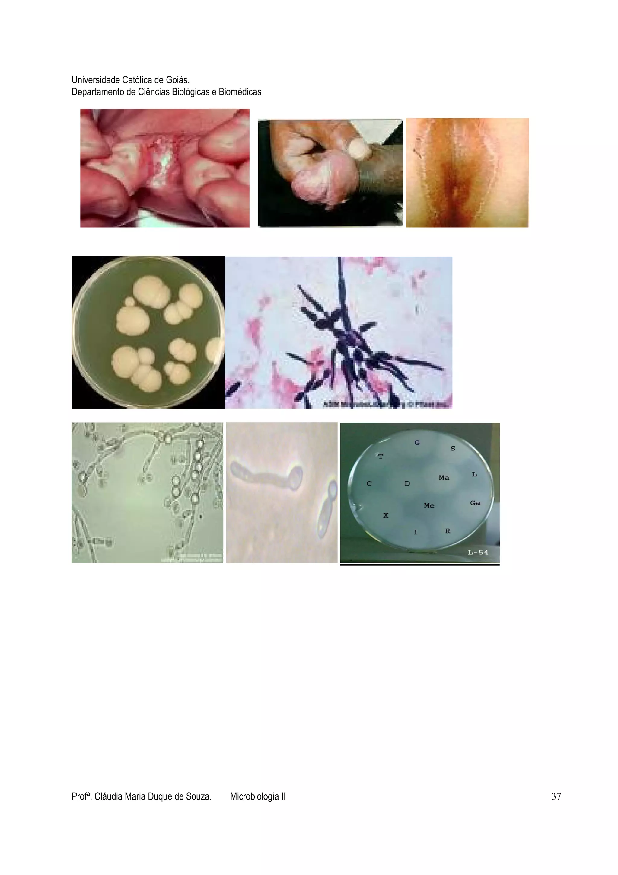 Universidade Católica de Goiás. 
Departamento de Ciências Biológicas e Biomédicas 
Profª. Cláudia Maria Duque de Souza. Microbiologia II 37 
 