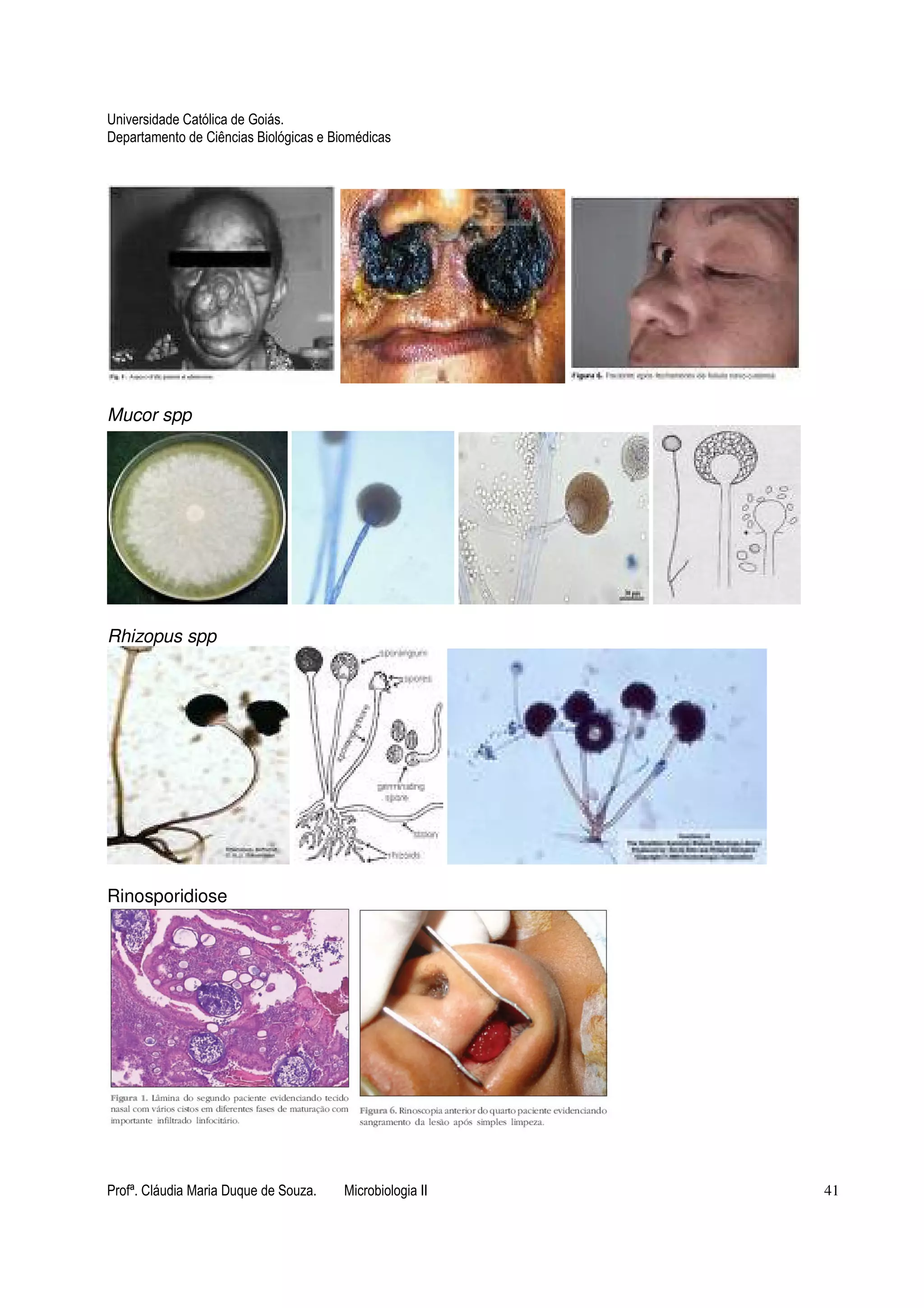 Universidade Católica de Goiás. 
Departamento de Ciências Biológicas e Biomédicas 
Mucor spp 
Rhizopus spp 
Rinosporidiose 
Profª. Cláudia Maria Duque de Souza. Microbiologia II 41 
 