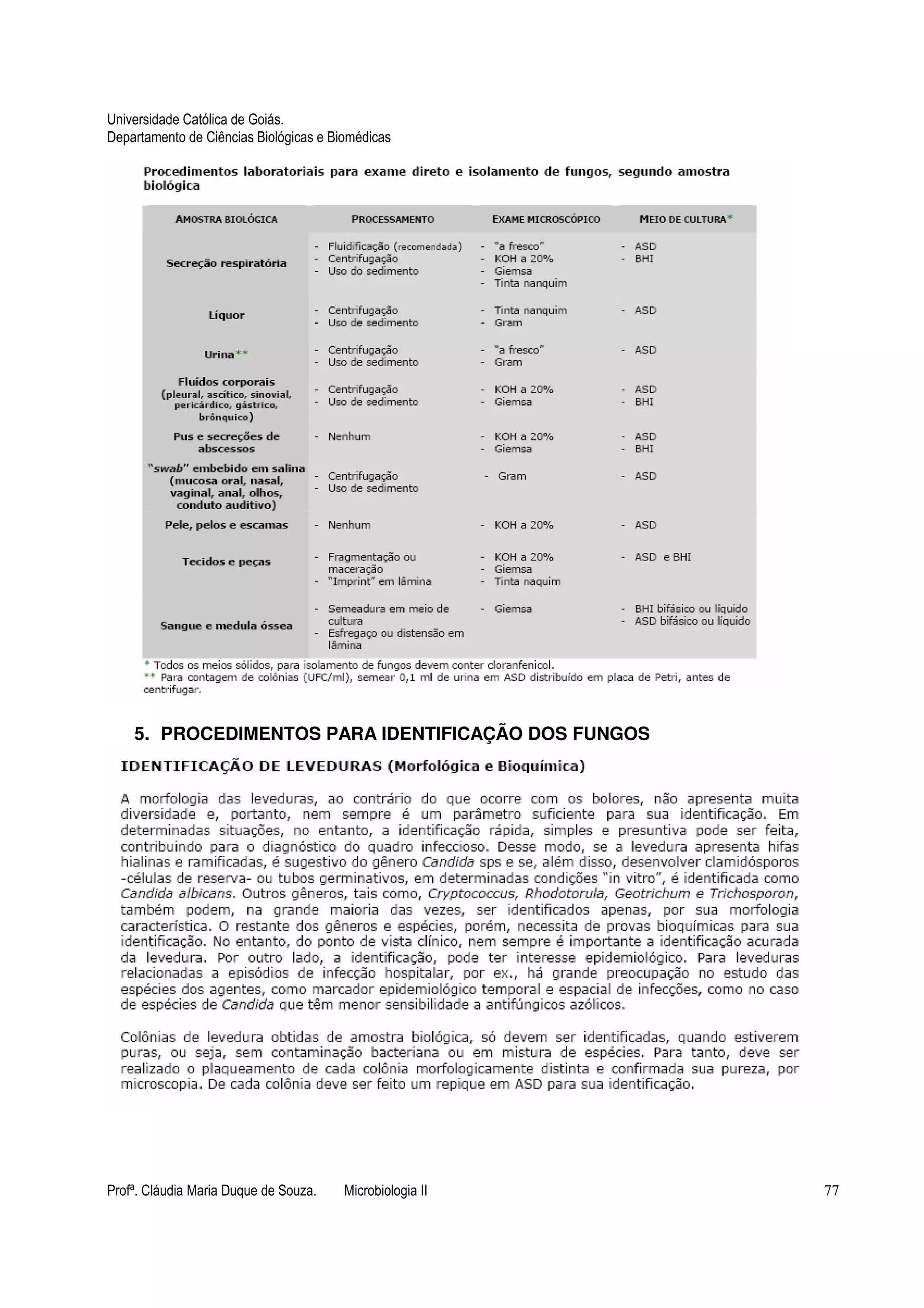 Universidade Católica de Goiás. 
Departamento de Ciências Biológicas e Biomédicas 
5. PROCEDIMENTOS PARA IDENTIFICAÇÃO DOS FUNGOS 
Profª. Cláudia Maria Duque de Souza. Microbiologia II 77 
 