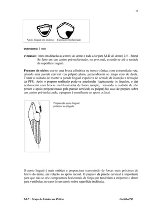 espessura: 1 mm
extensão: 1mm em direção ao centro do dente e toda a largura M-D do dente( 2,5 - 3mm)
Se feito em um canino pré-molarizado, na proximal, estende-se até a metade
da superfície lingual.
Preparo do nicho: usa-se uma broca cilíndrica ou tronco-cônica, com extremidade reta,
criando uma parede cervical (ou pulpar) plana, perpendicular ao longo eixo do dente.
Tomar o cuidado de manter a parede lingual expulsiva no sentido de inserção e remoção
da PPR. Após o preparo realizado pode-se arredondar ligeiramente os ângulos, e dar
acabamento com brocas multilaminadas de baixa rotação, tomando o cuidado de não
perder o apoio proporcionado pela parede cervical( ou pulpar).No caso de preparo sobre
um canino pré-molarizado, o preparo é semelhante ao apoio oclusal.
O apoio lingual é mais estético e proporciona transmissão de forças mais próximas do
fulcro do dente, em relação ao apoio incisal. O preparo da parede cervical é importante
para que não se crie componentes horizontais de força que tenderiam a empurrar o dente
para vestibular, no caso de um apoio sobre superfície inclinada.
GEP – Grupo de Estudos em Prótese Curitiba/PR
12
Apoio lingual em incisivo Canino premolarizado
Preparo do apoio lingual
próximo ao cíngulo
 