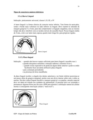 Tipos de conectores maiores inferiores
3.3.e) Barra Lingual
Indicação: praticamente universal, classes I, II, III, e IV
A barra lingual é a forma clássica de conector maior inferior. Tem forma de meia-pêra,
sendo o bordo mais volumoso no lado inferior ou lingual. Deve manter-se afastada da
margem gengival 3 a 4 mm, para não comprometer a irrigação sangüínea, mas ao mesmo
tempo não deve interferir com os tecidos móveis do assoalho bucal. Possui largura média
de 4 mm, e deve ser tanto mais espessa quanto mais longa for, para propiciar rigidez.
3.3.f ) Placa lingual
Indicação: - quando não houver espaço suficiente para barra lingual ( assoalho raso )
- quando desejamos aumentar a retenção indireta ( extremos livres )
- quando existe expectativa de perda de algum dente anterior ( pode-se então
facilmente fixar um dente artificial à placa lingual)
- para contenção periodontal;
- na presença de tórus mandibular.
A placa lingual recobre o cíngulo dos dentes anteriores e no limite inferior posiciona-se
um pouco além da gengiva marginal, porém com um alívio interno sobre esta e sobre as
ameias. Devido à placa lingual encobrir a margem gengival e as papilas, atenção especial
deve ser dada em relação aos cuidados de manutenção. O paciente deve ser orientado a
permanecer algumas horas por dia sem a PPR para permitir a esfoliação natural de células
mortas e conseqüente renovação celular ( “turn-over”).
GEP – Grupo de Estudos em Prótese Curitiba/PR
26
Barra Lingual
Placa Lingual
 