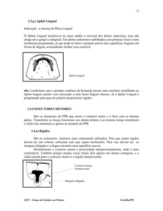 3.3.g ) Splint Lingual
Indicação: a mesma da Placa Lingual
O Splint Lingual localiza-se no terço médio e cervical dos dentes anteriores, mas não
chega até a gengiva marginal. Em dentes anteriores reabilitados com próteses fixas é mais
facilmente programado, já que pode-se fazer o preparo prévio das superfícies linguais em
forma de degrau, acomodando melhor esse conector.
obs. Lembramos que o grampo contínuo de Kennedy possui uma estrutura semelhante ao
Splint lingual, porém vem associado a uma barra lingual clássica. Já o Splint Lingual é
programado para que ele próprio proporcione rigidez .
3.4.CONECTORES MENORES
São os elementos da PPR que unem o conector maior e a base com as demais
partes. Transferem as forças funcionais aos dentes pilares e ao mesmo tempo transferem
o efeito dos retentores e apoios ao restante da PPR.
3.4.a) Rígidos
São os conectores menores mais comumente utilizados. Para que sejam rígidos
devem ter um volume suficiente sem que sejam incômodos. Para isso devem ter as
margens delgadas ( a língua encontra uma superfície suave).
Normalmente o conector menor é posicionado interproximalmente, onde é mais
confortável. Também porque muitas vezes temos dois apoios em dentes contíguos, e a
saída natural para o conector menor é a região interproximal .
GEP – Grupo de Estudos em Prótese Curitiba/PR
27
Splint Lingual
Conector menor
interproximal
Margens delgadas
 