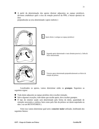  A partir da determinação dos apoios diretos( adjacentes ao espaço protético),
devemos estabelecer qual o eixo de rotação possível da PPR, e buscar apoio(s) na
área
perpendicular ao eixo determinado ( apoio indireto )
Localizados os apoios, vamos determinar então os grampos. Seguimos as
seguintes regras:
 Todo dente adjacente ao espaço protético deve receber retenção.
 Salvo algumas exceções, todo dente que recebe apoio, deve receber grampos.
 O tipo do retentor usado será determinado pela forma do dente, quantidade de
retenção necessária e estética, bem como pelo fato da prótese ser dento-suportada ou
não ( ver em RETENTORES ).
Feito isso vamos determinar qual será o conector maior utilizado, lembrando dos
seguintes fatores:
GEP – Grupo de Estudos em Prótese Curitiba/PR
33
1
2
3
Apoio direto ( contíguo ao espaço protético)
Segundo apoio determinado o mais distante possível, e linha de
fulcro determinada.
Terceiro apoio determinado perpendicularmente ao fulcro de
rotação da prótese
 