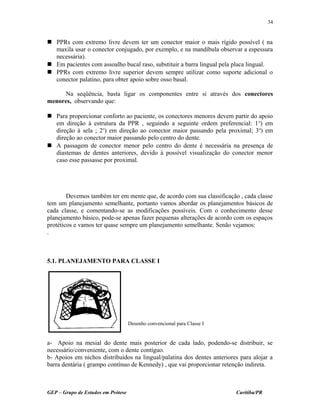  PPRs com extremo livre devem ter um conector maior o mais rígido possível ( na
maxila usar o conector conjugado, por exemplo, e na mandíbula observar a espessura
necessária).
 Em pacientes com assoalho bucal raso, substituir a barra lingual pela placa lingual.
 PPRs com extremo livre superior devem sempre utilizar como suporte adicional o
conector palatino, para obter apoio sobre osso basal.
Na seqüência, basta ligar os componentes entre si através dos conectores
menores, observando que:
 Para proporcionar conforto ao paciente, os conectores menores devem partir do apoio
em direção à estrutura da PPR , seguindo a seguinte ordem preferencial: 1o
) em
direção à sela ; 2o
) em direção ao conector maior passando pela proximal; 3o
) em
direção ao conector maior passando pelo centro do dente.
 A passagem de conector menor pelo centro do dente é necessária na presença de
diastemas de dentes anteriores, devido à possível visualização do conector menor
caso esse passasse por proximal.
Devemos também ter em mente que, de acordo com sua classificação , cada classe
tem um planejamento semelhante, portanto vamos abordar os planejamentos básicos de
cada classe, e comentando-se as modificações possíveis. Com o conhecimento desse
planejamento básico, pode-se apenas fazer pequenas alterações de acordo com os espaços
protéticos e vamos ter quase sempre um planejamento semelhante. Senão vejamos:
.
5.1. PLANEJAMENTO PARA CLASSE I
a- Apoio na mesial do dente mais posterior de cada lado, podendo-se distribuir, se
necessário/conveniente, com o dente contíguo.
b- Apoios em nichos distribuídos na lingual/palatina dos dentes anteriores para alojar a
barra dentária ( grampo contínuo de Kennedy) , que vai proporcionar retenção indireta.
GEP – Grupo de Estudos em Prótese Curitiba/PR
34
Desenho convencional para Classe I
 