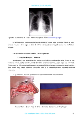 QUALIDADE DO AR INTERNO
Figura 16 – Quadro típico de Fibrose Pulmonar Idiopática - Fonte www.medlineplus.gov
Os sintomas mais comuns são dificuldade respiratória, tosse, perda de apetite, perda de peso,
cansaço, fraqueza e dores vagas no tórax. O esforço excessivo do coração pode levar a uma insuficiência
cardíaca.
8.2 Doenças Ocupacionais das Vias Aéreas Superiores
8.2.1 Rinites Alérgicas e Irritativas
Rinites Alérgica são provenientes de Animais de laboratório, grãos de café verde, farinha de trigo,
poeira de cereais, cedro vermelho,anidrido trimetílico e ftálico,isocianatos, papel cópia não carbonado.
Existem mais de 200 substâncias listadas como causa de Rinites Irritativas, entre eles os halogênios (flúor,
cloro, bromo, iodo), e seus compostos, dos ácidos fortes, e de solventes orgânicos com baixo ponto de
evaporação.
As figuras abaixo mostram quadros típicos de Rinite e Dermatite respectivamente.
Figuras 17e18 – Quadro Típico de Rinite e Dermatite - Fonte www.medlineplus.gov
Eng. José Edson Basto – CREA SC 01 058125-4 39
 