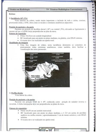 Técnico   em Radiologia                       204 Técnicas   Radiológicas   Convencionais

Rotina~

1) Incidência AP (PA)
        Vista anterior do cramo, sendo muito importante a in.clusão de toda a calota, craniana,
priorizando então, o SNC, bem como os tecidos e estruturas anatômicas adjacentes.

Posição do paciente e da parte
       Paciente em posição de decúbito dorsal ( AP ) ou ventral (PA), elevando-se ligeiramente o
mesmo até que a LIOM esteja perpendicular ao pIa0 da mesa.
Fatores de exposição
           • Filme 18x24cm em sentido longitudinal.
           • RC localizado para um ponto no plano mediano, na glabela, com DFoFi mínima.
           • O exame deve ser realizado em apnéia total.
Qualidades da imagem
           • Uma boa imagem de crânio, nesta incidência demonstra os contornos de
               praticamente   todas estruturas anatômicas,    como também, deve facilitar a
               visualização dos seios paranasais.




2- Perfila direito
         Vista lateral do crânio.

Posição do paciente e da partes
        Paciente em posição OAD de ± 45°, conhecida como poslçao do nadador lllversa o
invertida. A linha interpupilar deve ser perpendicular ao plano da mesa.

Fatores de exposição:
          • Filme 24x30 cm em sentido transversal.
          • RC localizado para um ponto no plano mediano, a ± 2,5 cm acima do pavilhão
              auditivo ou orelha externa ( aproximadamente 5 cm do meato acústico), com DFoFi
              mínima.
           • O exame deve ser realizado em apnéia total.
 