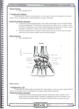 Técnico em Radiologia                                                   215 Técnicas Radiológicas Convencionais

Fatores técnicos:
           • Idem incidência PA.

3) Incidência PA-Obígua
        Visualização de falanges, metecarpianos, osso do carpo e todas as articulações em posição
oblíqua. Deve-se atentar para a demonstração dos espaços articulares.

Posição do paciente e da parte:
          • O paciente ficará na posição geral, com a mão em pronação, até ma posição oblíqua
              de aproximadamente 45° afastando-se ligeiramente os dedos. Deve-se apoiar a mão
              com bloco cuneiforme ou em escala radiotransparente de modo que os dedos estejam
              separados e paralelos ao filme ( daí a pouca realização da técnica).
          • Alternativamente pode-se realizar o mesmo processo sem o uso do bloco de apóio,
              sendo que nessa rotina os dedos da mão estarão paralelos.

Fatores técnicos:
           • Idem incidência PA.


                                                                    Punhos




                     Proc!'sso   'l'stilõide da ulna

                                                                                               Tubéorculo   do rádio



                                 Osso   so?miluo<or

                                 Osso pisiformol!'
                                                                                                Proco?$SO iIl'$lilóidEo do rádio
                                                                                                                                   ,

                                                                                                        Ossotrapelóide


                                 Osso capl<o(o




                                                                                                            1
                                                                ;4; i
                                                      _______
                                                                             V
                                                                              3
                                                                                                       ./
                                                                    OS50S   moi'tic,Í,rpicos




Rotina básica

1) Incidência PA ( AP)
        Visualização de região média e proximal dos metacarpianos, ossos do carpo, região distaI do
rádio e da ulna bem como as articulações associadas e parte moles pertinentes.
Posição do paciente e da parte:
            • O paciente ficará na mesma posição anterior, sendo que a parte ( punho e mão)
                deverá estar em posição lateral verdadeira ( palpação do processo estilóide), com
                dedos fletidos confortavelmente. Se possível colocar bloco ou suporte de apoio.
 