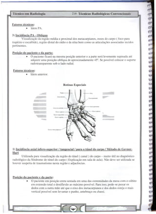Técnico em Radiologia                                                  216 Técnicas Radiológicas Convencionais


Fatores técnicos:
           •   Idem PA.

3) Incidência PA - Oblíqua
        Visualização da região média e proximal dos metacarpianos, ossos do carpo ( foco para
trapézio e escafóide), rcgião distai do rádio e da ulna bem como as articulações associadas tecidos
pertinentes.

Posicão do paciente e da parte:
           •   O paciente ficará na mesma posição anterior e a parte será levemente supinada até
               adquirir uma posição oblíqua de aproximadamente 45°. Se possível colocar o suporte
               radiotransparente sob o lado radial.

Fatores técnicos:
           •   Idem anterior.


                                                                 Rotinas Especiais

                                                             Rádio
                      •••••••••                                                      UII.t



                    LM& d,                           OssolUl'l~O




                       -
                                             OiSOCI~p9lóid.
                                                OSSOllapfZIO




                                  Qssos lTle'I..IIcáfptoos




1) Incidência axial ínfero-superior I tangenciall para o túnel do carpo I Método de Gavnor-
Hart
        Utilizada para visualização da região do túnel ( canal) do carpa - muito útil no diagnóstico
radiológico da Síndrome do túnel do carpo ( Explicação em sala de aula). Não deve ser utilizada se
houver suspeita de traumatismo nesta região e adjacências.




Posição do paciente e da parte:
           •   O paciente em posição ereta sentada em uma das extremidades da mesa com o cúbito
               em extensão total e dosiflexão ao máximo possível. P.ara isso, pode-se puxar os
               dedos com a outra mão até que o eixo dos metacarpianos e dos dedos esteja o mais
               vertical possível sem levantar o punho, antebraço ou chassi.




                                                                                              ~.
 