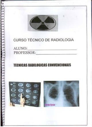 •




CURSO TÉCNICO DE RADIOLOGIA

ALUNO:                           _
PROFESSOR:


TECNICIS RIOllOBICIS CONVENCIONAIS
 