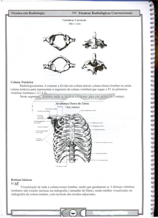 COIPO do ut,!",no
208 Técnicas Radiológicas Convencionais
Vértebras Cervicais
Atlas e A.xis
Co~t~lu
.•.•rdi,Jelfu
Visualização de toda a coluna toraco-Iombar, sendo que geralmente as 3 últimas vértebras
lombares não estarão inclusas na radiografia ( tamanho do filme), sendo melhor visualizadas na
radiografia da coluna lombar, com inclusão dos tecidos adjacentes.
Arcabouço Ósseo do Tórax
Cl1~lcl.lb Vista Anterior
Rotinas básicas
l)AP
Técnico em Radiologia
Coluna Torácica
Radiologicamente, é comum a divisão em coluna dorsal, coluna tóraco-lombar ou ainda
coluna torácica para representar o segmento da coluna vertebral que segue a T I ás primeiras
vértebras lombares ( Ll-L2).
Neste segmento, veremos então as técnicasexístentes para este protQ~oIO-(rotina).
 