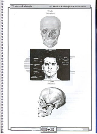 Técnico em Radiologia 203 Técnicas Radiológicas Convencionais
Crânio
Vista AnteJior
Crânio
Vista Lateral
 