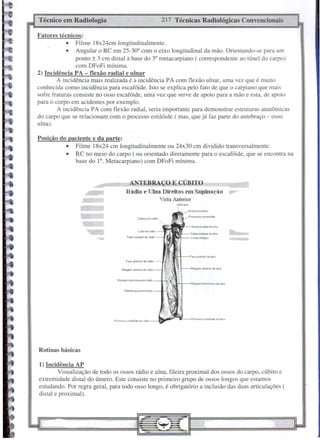 217 Técnicas Radiológicas Convencionais
Colo lJorWIo
Tubflosl4a<l. do rádio
Ol,krano
ANTEBRAÇO E CÚBITO
Rádio e Ulna Direitos em Supinaçilo
Vista Antetior
-
1*19_111§Jll
mr
Rotinas básicas
Técnico em Radiologia
1) Incidência AP
Visualização de todo os ossos rádio e ulna, fileira proximal dos ossos do carpo, cúbito e
extremidade distaI do úmero. Este consiste no primeiro grupo de ossos longos que estamos
estudando. Por regra geral, para todo osso longo, é obrigatório a inclusão das duas articulações (
distai e proximal).
Fatores técnicos:
• Filme 18x24cm longitudinalmente.
• Angular o RC em 25-30° com o eixo longitudinal da mão. Orientando-se para um
ponto ± 3 cm distai ã base do 3° metacarpiano ( correspondente ao túnel do carpo)
com DFoFi núnima.
2) Incidência PA - flexão radial e nInar
A incidência mais realizada é a incidência PA com flexão ulnar, uma vez que é muito
conhecida como incidência para escafóide. Isto se explica pelo fato de que o carpiano que mais
sofre fraturas consiste no osso escafóide, uma vez que serve de apoio para a mão e esta, de apoio
para o corpo em acidentes por exemplo.
A incidência PA com flexão radial, seria importante para demonstrar estruturas anatômicas
do carpo que se relacionam com o processo estilóide ( mas, que já faz parte do antebraço - osso
ulna).
Posição do paciente e da parte:
• Filme 18x24 cm longitudinalmente ou 24x30 em dividido transversalmente.
• RC no meio do carpo ( ou orientado diretamente para o escafóide, que se encontra na
base do l°. Metacarpiano) com DFoFi mínima.
 