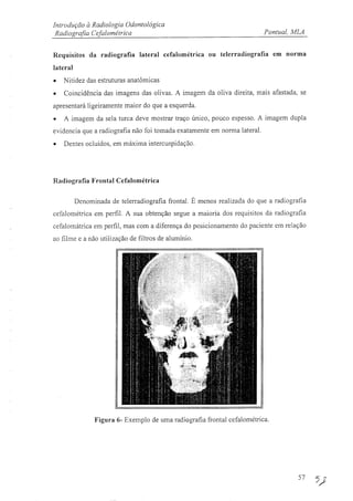 Apostila de radiologia odontológica