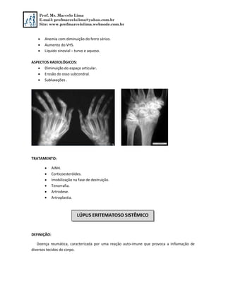 Prof. Ms. Marcelo Lima
E-mail: profmarcelolima@yahoo.com.br
Site: www.profmarcelolima.webnode.com.br
 Anemia com diminuição do ferro sérico.
 Aumento do VHS.
 Líquido sinovial – turvo e aquoso.
ASPECTOS RADIOLÓGICOS:
 Diminuição do espaço articular.
 Erosão do osso subcondral.
 Subluxações .
TRATAMENTO:
 AINH.
 Corticoesteróides.
 Imobilização na fase de destruição.
 Tenorrafia.
 Artrodese.
 Artroplastia.
DEFINIÇÃO:
Doença reumática, caracterizada por uma reação auto-imune que provoca a inflamação de
diversos tecidos do corpo.
LÚPUS ERITEMATOSO SISTÊMICO
 