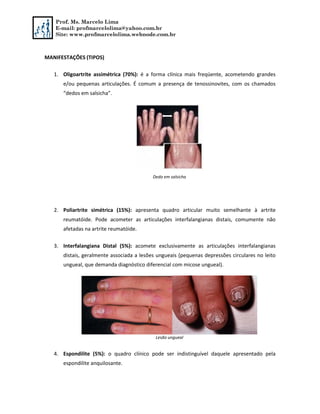 Prof. Ms. Marcelo Lima
E-mail: profmarcelolima@yahoo.com.br
Site: www.profmarcelolima.webnode.com.br
MANIFESTAÇÕES (TIPOS)
1. Oligoartrite assimétrica (70%): é a forma clínica mais freqüente, acometendo grandes
e/ou pequenas articulações. É comum a presença de tenossinovites, com os chamados
“dedos em salsicha”.
Dedo em salsicha
2. Poliartrite simétrica (15%): apresenta quadro articular muito semelhante à artrite
reumatóide. Pode acometer as articulações interfalangianas distais, comumente não
afetadas na artrite reumatóide.
3. Interfalangiana Distal (5%): acomete exclusivamente as articulações interfalangianas
distais, geralmente associada a lesões ungueais (pequenas depressões circulares no leito
ungueal, que demanda diagnóstico diferencial com micose ungueal).
Lesão ungueal
4. Espondilite (5%): o quadro clínico pode ser indistinguível daquele apresentado pela
espondilite anquilosante.
 