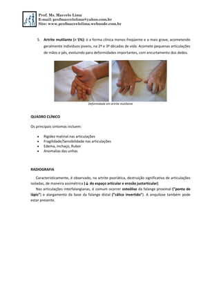 Prof. Ms. Marcelo Lima
E-mail: profmarcelolima@yahoo.com.br
Site: www.profmarcelolima.webnode.com.br
5. Artrite mutilante (< 5%): é a forma clínica menos freqüente e a mais grave, acometendo
geralmente indivíduos jovens, na 2ª e 3ª décadas de vida. Acomete pequenas articulações
de mãos e pés, evoluindo para deformidades importantes, com encurtamento dos dedos.
Deformidade em artrite mutilante
QUADRO CLÍNICO
Os principais sintomas incluem:
 Rigidez matinal nas articulações
 Fragilidade/Sensibilidade nas articulações
 Edema, Inchaço, Rubor
 Anomalias das unhas
RADIOGRAFIA
Caracteristicamente, é observado, na artrite psoriática, destruição significativa de articulações
isoladas, de maneira assimétrica (↓ do espaço articular e erosão justarticular)
Nas articulações interfalangianas, é comum ocorrer osteólise da falange proximal (”ponta de
lápis”) e alargamento da base da falange distal (”cálice invertido”). A anquilose também pode
estar presente.
 