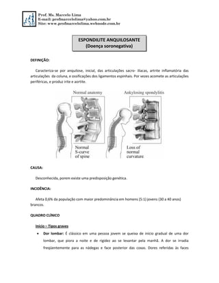 Prof. Ms. Marcelo Lima
E-mail: profmarcelolima@yahoo.com.br
Site: www.profmarcelolima.webnode.com.br
DEFINIÇÃO:
Caracteriza-se por anquilose, inicial, das articulações sacro- ilíacas, artrite inflamatória das
articulações da coluna, e ossificações dos ligamentos espinhais. Por vezes acomete as articulações
periféricas, e produz irite e aortite.
CAUSA:
Desconhecida, porem existe uma predisposição genética.
INCIDÊNCIA:
Afeta 0,6% da população com maior predominância em homens (5:1) jovens (30 a 40 anos)
brancos.
QUADRO CLÍNICO
Início – Tipos graves
 Dor lombar: É clássico em uma pessoa jovem se queixa de início gradual de uma dor
lombar, que piora a noite e de rigidez ao se levantar pela manhã. A dor se irradia
freqüentemente para as nádegas e face posterior das coxas. Dores referidas às faces
ESPONDILITE ANQUILOSANTE
(Doença soronegativa)
 