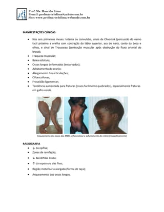 Prof. Ms. Marcelo Lima
E-mail: profmarcelolima@yahoo.com.br
Site: www.profmarcelolima.webnode.com.br
MANIFESTAÇÕES CLÍNICAS
 Nos seis primeiros meses: tetania ou convulsão, sinais de Chvostek (percussão do nervo
facil próximo a orelha com contração do lábio superior, asa do nariz, canto da boca e
olhos, e sinal de Trousseau (contração muscular após obstrução do fluxo arterial do
braço);
 Fraqueza muscular;
 Baixa estatura;
 Ossos longos deformados (encurvados);
 Achatamento do cranio;
 Alargamento das articulações;
 Cifoescolioses;
 Frouxidão ligamentar;
 Tendência aumentada para fraturas (ossos facilmente quebrados), especialmente fraturas
em galho verde.
Arqueamento dos ossos dos MMII, cifoescoliose e achatamento do crânio (respectivamente)
RADIOGRAFIA
 ↓ da epífise;
 Zonas de rarefação;
 ↓ da cortical óssea;
 ↑ da espessura das físes;
 Região metafisária alargada (forma de taça);
 Arqueamento dos ossos longos.
 