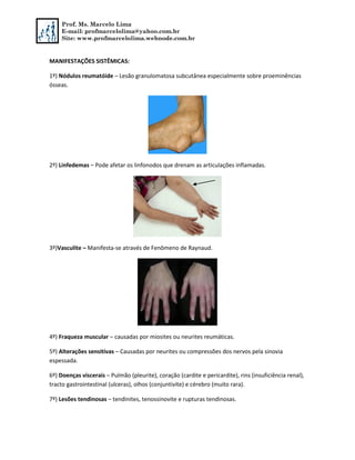 Prof. Ms. Marcelo Lima
E-mail: profmarcelolima@yahoo.com.br
Site: www.profmarcelolima.webnode.com.br
MANIFESTAÇÕES SISTÊMICAS:
1º) Nódulos reumatóide – Lesão granulomatosa subcutânea especialmente sobre proeminências
ósseas.
2º) Linfedemas – Pode afetar os linfonodos que drenam as articulações inflamadas.
3º)Vasculite – Manifesta-se através de Fenômeno de Raynaud.
4º) Fraqueza muscular – causadas por miosites ou neurites reumáticas.
5º) Alterações sensitivas – Causadas por neurites ou compressões dos nervos pela sinovia
espessada.
6º) Doenças viscerais – Pulmão (pleurite), coração (cardite e pericardite), rins (insuficiência renal),
tracto gastrointestinal (ulceras), olhos (conjuntivite) e cérebro (muito rara).
7º) Lesões tendinosas – tendinites, tenossinovite e rupturas tendinosas.
 