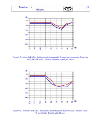 Acústica e
Ruídos
116
dB
0
20
40
60
80
100
125
250
500
1k
2k
3k
4k
6k
8k
Hz
Figura 9.2 – Início da PAIR – Audiograma de um operador de martelete pneumático; Ruído no
local : 110 dB; idade : 24 anos; tempo de exposição: 3 anos
dB
0
20
40
60
80
100
125
250
500
1k
2k
3k
4k
6k
8k
Hz
Figura 9.2 – Aumento da PAIR – Audiograma de um forjador; Ruído no local : 120 dB; idade:
41 anos; tempo de exposição: 12 anos
 