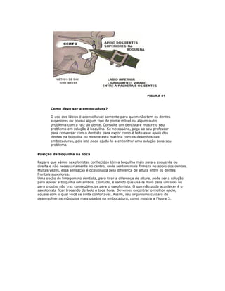 Como deve ser a embocadura?

       O uso dos lábios é aconselhável somente para quem não tem os dentes
       superiores ou possui algum tipo de ponte móvel ou algum outro
       problema com a raiz do dente. Consulte um dentista e mostre o seu
       problema em relação à boquilha. Se necessário, peça ao seu professor
       para conversar com o dentista para expor como é feito esse apoio dos
       dentes na boquilha ou mostre esta matéria com os desenhos das
       embocaduras, pois isto pode ajudá-lo a encontrar uma solução para seu
       problema.

Posição da boquilha na boca

Repare que vários saxofonistas conhecidos têm a boquilha mais para a esquerda ou
direita e não necessariamente no centro, onde sentem mais firmeza no apoio dos dentes.
Muitas vezes, essa sensação é ocasionada pela diferença de altura entre os dentes
frontais superiores.
Uma seção de limagem no dentista, para tirar a diferença de altura, pode ser a solução
para apoiar a boquilha em ambos. Contudo, é sabido que usá-la mais para um lado ou
para o outro não traz conseqüências para o saxofonista. O que não pode acontecer é o
saxofonista ficar trocando de lado a toda hora. Devemos encontrar o melhor apoio,
aquele com o qual você se sinta confortável. Assim, seu organismo cuidará de
desenvolver os músculos mais usados na embocadura, como mostra a Figura 3.
 