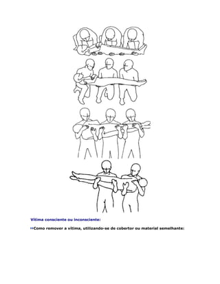 Vítima consciente ou inconsciente:

 Como remover a vítima, utilizando-se de cobertor ou material semelhante:
 