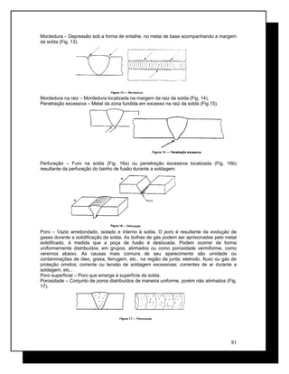 Mordedura – Depressão sob a forma de entalhe, no metal de base acompanhando a margem
da solda (Fig. 13).
Mordedura na raiz – Mordedura localizada na margem da raiz da solda (Fig. 14).
Penetração excessiva – Metal da zona fundida em excesso na raiz da solda (Fig.15).
Perfuração – Furo na solda (Fig. 16a) ou penetração excessiva localizada (Fig. 16b)
resultante da perfuração do banho de fusão durante a soldagem.
Poro – Vazio arredondado, isolado e interno à solda. O poro é resultante da evolução de
gases durante a solidificação da solda. As bolhas de gás podem ser aprisionadas pelo metal
solidificado, à medida que a poça de fusão é deslocada. Podem ocorrer de forma
uniformemente distribuídos, em grupos, alinhados ou como porosidade vermiforme, como
veremos abaixo. As causas mais comuns de seu aparecimento são umidade ou
contaminações de óleo, graxa, ferrugem, etc.. na região da junta; eletrodo, fluxo ou gás de
proteção úmidos; corrente ou tensão de soldagem excessivas; correntes de ar durante a
soldagem, etc.. .
Poro superficial – Poro que emerge à superfície da solda.
Porosidade – Conjunto de poros distribuídos de maneira uniforme, porém não alinhados (Fig.
17).
81
 