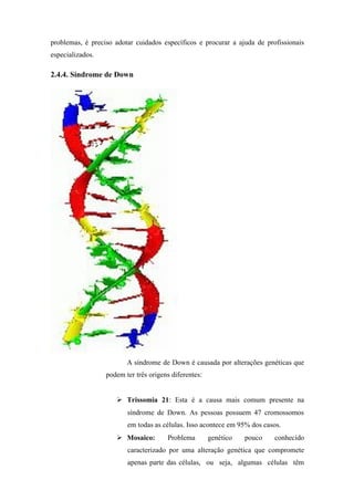 problemas, é preciso adotar cuidados específicos e procurar a ajuda de profissionais
especializados.
2.4.4. Síndrome de Down
A síndrome de Down é causada por alterações genéticas que
podem ter três origens diferentes:
 Trissomia 21: Esta é a causa mais comum presente na
síndrome de Down. As pessoas possuem 47 cromossomos
em todas as células. Isso acontece em 95% dos casos.
 Mosaico: Problema genético pouco conhecido
caracterizado por uma alteração genética que compromete
apenas parte das células, ou seja, algumas células têm
 