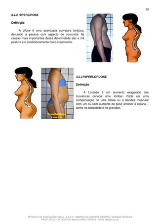 20
3.2.2 HIPERCIFOSE

Definição

     A cifose é uma acentuada curvatura torácica,
deixando a pessoa com aspecto de corcunda. As
causas mais importantes dessa deformidade são a má
postura e o condicionamento físico insuficiente.




                                                3.2.3 HIPERLORDOSE

                                                Definição

                                                     A Lordose é um aumento exagerado nas
                                                curvaturas cervical e/ou lombar. Pode ser uma
                                                compensação de uma cifose ou à flacidez muscular
                                                com um ou sem aumento de peso anterior à coluna –
                                                como na obesidade e na gravidez.




            APOSTILA DE EDUCAÇÃO FÍSICA - E.E.E.P. OSMIRA EDUARDO DE CASTRO - MORADA NOVA/CE
                      PROFº HECCTOR RODRIGO MAGALHÃES FREITAS - CREF 006283-G/CE
 