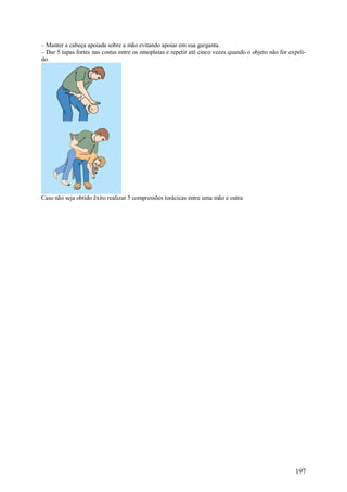 – Manter a cabeça apoiada sobre a mão evitando apoiar em sua garganta.
– Dar 5 tapas fortes nas costas entre os omoplatas e repetir até cinco vezes quando o objeto não for expeli-
do.




Caso não seja obtido êxito realizar 5 compressões torácicas entre uma mão e outra




                                                                                                       197
 