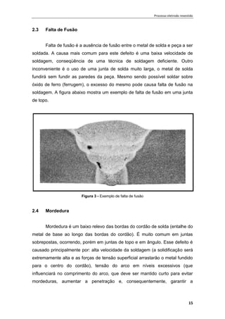 Processo eletrodo revestido
15
2.3 Falta de Fusão
Falta de fusão é a ausência de fusão entre o metal de solda e peça a ser
soldada. A causa mais comum para este defeito é uma baixa velocidade de
soldagem, conseqüência de uma técnica de soldagem deficiente. Outro
inconveniente é o uso de uma junta de solda muito larga, o metal de solda
fundirá sem fundir as paredes da peça. Mesmo sendo possível soldar sobre
óxido de ferro (ferrugem), o excesso do mesmo pode causa falta de fusão na
soldagem. A figura abaixo mostra um exemplo de falta de fusão em uma junta
de topo.
Figura 3 - Exemplo de falta de fusão
2.4 Mordedura
Mordedura é um baixo relevo das bordas do cordão de solda (entalhe do
metal de base ao longo das bordas do cordão). É muito comum em juntas
sobrepostas, ocorrendo, porém em juntas de topo e em ângulo. Esse defeito é
causado principalmente por: alta velocidade da soldagem (a solidificação será
extremamente alta e as forças de tensão superficial arrastarão o metal fundido
para o centro do cordão), tensão do arco em níveis excessivos (que
influenciará no comprimento do arco, que deve ser mantido curto para evitar
mordeduras, aumentar a penetração e, consequentemente, garantir a
 