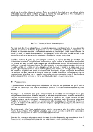 28
aderência da emulsão à base de poliéster. Sobre a emulsão é depositada uma camada de gelatina
endurecida, que tem como finalidade proteger a mesma. Ao todo, portanto, o filme radiográfico é
formado por sete camadas, como pode ser observado na figura 17.
Fig. 17 – Constituição de um filme radiográfico.
Na maior parte dos filmes radiográficos, a emulsão é depositada em ambos os lados da base, dobrando,
portanto, a quantidade de haletos de prata que pode ser sensibilizada, tendo como conseqüência um
aumento da velocidade do filme. Estas camadas são finas o bastante para serem processadas em um
tempo razoável. Em alguns filmes especiais, a emulsão é depositada em apenas um lado da base, o que
torna o filme mais lento, aumentando, entretanto, a definição da imagem radiográfica.
Quando a radiação X, gama ou a luz atingem a emulsão, as regiões do filme que recebem uma
quantidade suficiente de radiação sofrem uma mudança. Alguns íons de Br
-
são liberados e capturados
por íons de Ag
+
, Esta mudança é tão pequena que não é perceptível sem um processamento posterior
do filme e é chamada de imagem latente. Os grãos expostos tornam-se mais sensíveis ao processo de
redução quando em contato com uma solução química chamada revelador e a reação que ocorre
durante o processo de revelação resulta na formação de prata metálica, de coloração preta. Esta prata,
em suspensão na gelatina em ambos os lados da base, dá origem à imagem radiográfica. A quantidade
de partículas de prata metálica produzida é maior nas regiões da emulsão que receberam maiores
quantidades de radiação e menor naquelas que receberam uma quantidade menor. A distribuição da
prata metálica no filme, em maior ou menor quantidade, dá origem à imagem radiográfica.
7.1 Processamento
O processamento do filme radiográfico compreende um conjunto de operações em que o filme é
colocado em contato com uma série de substâncias químicas. O processamento envolve as seguintes
etapas:
Revelação - é o tratamento pelo qual a imagem latente é convertida em uma imagem visível, pela
redução seletiva dos cristais de haleto de prata da emulsão em prata metálica. O tempo de revelação
deve ser cuidadosamente controlado, de forma permitir a conversão dos cristais expostos em prata
metálica enquanto mantém os cristais não expostos como haletos de prata. O tempo de revelação é
função da temperatura do revelador e, normalmente, são fornecidos pelos fabricantes de filmes e
soluções de processamento tabelas que indicam o tempo de exposição adequado para uma determinada
faixa de temperaturas.
Banho de parada - o banho de parada tem como objetivo interromper a ação do revelador, retirando o
mesmo da superfície do filme. Pode ser utilizada a água comum, corrente, devendo todo o excesso de
revelador ser retirado antes de o filme ser colocado no banho fixador.
Fixação - é o tratamento pelo qual os cristais de haleto de prata não expostos são removidos do filme. O
fixador remove os cristais de haleto de prata, não reagindo com a prata metálica formada.
 