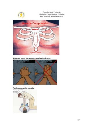 Engenharia de Produção
Disciplina: Segurança do Trabalho
Prof. Gustavo Antonio da Silva

Mãos no tórax para compressões torácicas

Posicionamento correto

114

 
