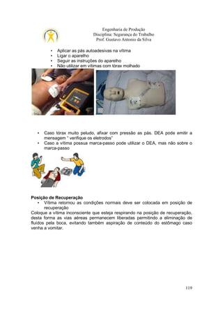Engenharia de Produção
Disciplina: Segurança do Trabalho
Prof. Gustavo Antonio da Silva
•
•
•
•

•
•

Aplicar as pás autoadesivas na vítima
Ligar o aparelho
Seguir as instruções do aparelho
Não utilizar em vítimas com tórax molhado

Caso tórax muito peludo, afixar com pressão as pás. DEA pode emitir a
mensagem “ verifique os eletrodos”
Caso a vítima possua marca-passo pode utilizar o DEA, mas não sobre o
marca-passo

Posição de Recuperação
• Vítima retornou as condições normais deve ser colocada em posição de
recuperação
Coloque a vítima inconsciente que esteja respirando na posição de recuperação,
desta forma as vias aéreas permanecem liberadas permitindo a eliminação de
fluídos pela boca, evitando também aspiração de conteúdo do estômago caso
venha a vomitar.

119

 