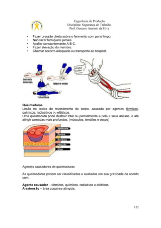 Engenharia de Produção
Disciplina: Segurança do Trabalho
Prof. Gustavo Antonio da Silva
•
•
•
•
•

Fazer pressão direta sobre o ferimento com pano limpo.
Não fazer torniquete jamais.
Avaliar constantemente A B C.
Fazer elevação do membro.
Chamar socorro adequado ou transporte ao hospital.

Queimaduras
Lesão no tecido de revestimento do corpo, causada por agentes térmicos,
químicos, radioativos ou elétricos.
Uma queimadura pode destruir total ou parcialmente a pele e seus anexos, e até
atingir camadas mais profundas. (músculos, tendões e ossos)

Agentes causadores de queimaduras
As queimaduras podem ser classificadas e avaliadas em sua gravidade de acordo
com:
Agente causador – térmicos, químicos, radiativos e elétricos.
A extensão – área corpórea atingida.

122

 