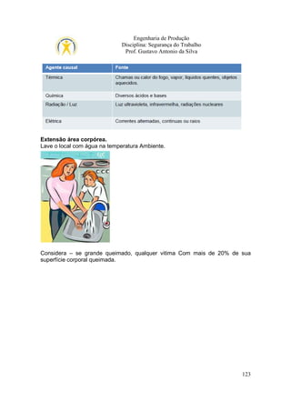 Engenharia de Produção
Disciplina: Segurança do Trabalho
Prof. Gustavo Antonio da Silva

Extensão área corpórea.
Lave o local com água na temperatura Ambiente.

Considera – se grande queimado, qualquer vitima Com mais de 20% de sua
superfície corporal queimada.

123

 
