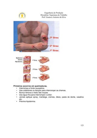 Engenharia de Produção
Disciplina: Segurança do Trabalho
Prof. Gustavo Antonio da Silva

Primeiros socorros em queimaduras.
• Interrompa a fonte causadora.
• Use cobertores ou lençóis para interromper as chamas.
• Nunca remova o resto das roupas.
• Use água fria para interromper o ardor.
• Jamais aplique spray, manteiga, cremes, óleos, pasta de dente, vaselina
etc.
• Previna hipotermia.

125

 