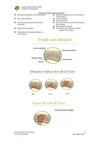 Escola de Massoterapia SOGAB
           Apostila de Fisiopatologia I

                                     Neoplasia (benigna) x Neoplasia (maligna)
    Não apresenta anaplasia (bem diferenciados);                Apresenta anaplasias (pouco diferenciados ou
                                                                indiferenciados).
    Não produz metástases;                                      Produz metástases
                                                                Dano compressivo.
    Dano Compressivo pode afetar estruturas                     Dano direto do comprometimento funcional do
    anatômicas.                                                 tecido alterado.
                                                                Mau prognóstico em geral.
    Em geral Bom prognóstico                                    Denominado como Câncer ou neoplasia
                                                                      maligna/ tumor maligno
    Denominado como Neoplasia Benigna ou
    Tumor Benigno




Prof: Pablo Fabrício Flores Dias                                                                               6
Profª; Cíntia Schneider                                                                  www.sogab.com.br
 