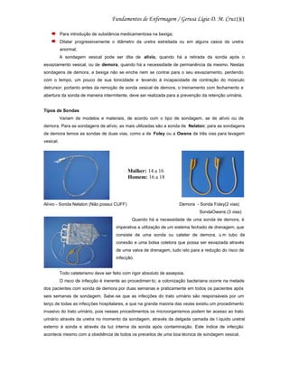181
Para introdução de substância medicamentosa na bexiga;
Dilatar progressivamente o diâmetro da uretra estreitada ou em alguns casos da uretra
anormal;
A sondagem vesical pode ser dita de alívio, quando há a retirada da sonda após o
esvaziamento vesical, ou de demora, quando há a necessidade de permanência da mesmo. Nestas
sondagens de demora, a bexiga não se enche nem se contrai para o seu esvaziamento, perdendo
com o tempo, um pouco de sua tonicidade e levando à incapacidade de contração do músculo
detrursor; portanto antes da remoção de sonda vesical de demora, o treinamento com fechamento e
abertura da sonda de maneira intermitente, deve ser realizada para a prevenção da retenção urinária.

Tipos de Sondas
Variam de modelos e materiais, de acordo com o tipo de sondagem, se de alívio ou de
demora. Para as sondagens de alívio, as mais utilizadas são a sonda de Nelaton; para as sondagens
de demora temos as sondas de duas vias, como a de Foley ou a Owens de três vias para lavagem
vesical.

Mulher: 14 a 16
Homem: 16 a 18

Alívio - Sonda Nelaton (Não possui CUFF)

Demora - Sonda Foley(2 vias)
SondaOwens (3 vias)
Quando há a necessidade de uma sonda de demora, é

imperativa a utilização de um sistema fechado de drenagem, que
consiste de uma sonda ou cateter de demora, u m tubo de
conexão e uma bolsa coletora que possa ser esvaziada através
de uma valva de drenagem, tudo isto para a redução do risco de
infecção.

Todo cateterismo deve ser feito com rigor absoluto de assepsia.
O risco de infecção é inerente ao procedimen to; a colonização bacteriana ocorre na metade
dos pacientes com sonda de demora por duas semanas e praticamente em todos os pacientes após
seis semanas de sondagem. Sabe -se que as infecções do trato urinário são responsáveis por um
terço de todas as infecções hospitalares, e que na grande maioria das vezes existiu um procedimento
invasivo do trato urinário, pois nesses procedimentos os microorganismos podem ter acesso ao trato
urinário através da uretra no momento da sondagem, através da delgada camada de l íquido uretral
externo à sonda e através da luz interna da sonda após contaminação. Este índice de infecção
acontece mesmo com a obediência de todos os preceitos de uma boa técnica de sondagem vesical.

 