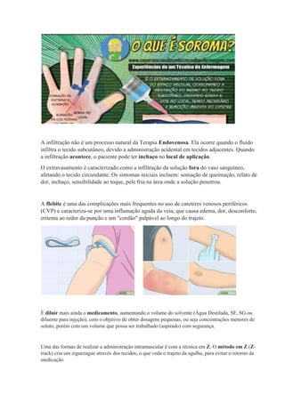 A infiltração não é um processo natural da Terapia Endovenosa. Ela ocorre quando o fluido
infiltra o tecido subcutâneo, devido a administração acidental em tecidos adjacentes. Quando
a infiltração acontece, o paciente pode ter inchaço no local de aplicação.
O extravasamento é caracterizado como a infiltração da solução fora do vaso sanguíneo,
afetando o tecido circundante. Os sintomas iniciais incluem: sensação de queimação, relato de
dor, inchaço, sensibilidade ao toque, pele fria na área onde a solução penetrou.
A flebite é uma das complicações mais frequentes no uso de cateteres venosos periféricos
(CVP) e caracteriza-se por uma inflamação aguda da veia, que causa edema, dor, desconforto,
eritema ao redor da punção e um "cordão" palpável ao longo do trajeto.
É diluir mais ainda o medicamento, aumentando o volume do solvente (Água Destilada, SF, SG ou
diluente para injeção), com o objetivo de obter dosagens pequenas, ou seja concentrações menores de
soluto, porém com um volume que possa ser trabalhado (aspirado) com segurança.
Uma das formas de realizar a administração intramuscular é com a técnica em Z. O método em Z (Z-
track) cria um ziguezague através dos tecidos, o que veda o trajeto da agulha, para evitar o retorno da
medicação.
 
