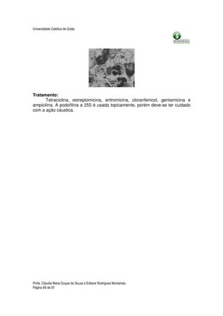 Universidade Católica de Goiás




Tratamento:
      Tetraciclina, estreptomicina, eritromicina, cloranfenicol, gentamicina e
ampicilina. A podofilina a 255 é usada topicamente, porém deve-se ter cuidado
com a ação cáustica.




Profa. Cláudia Maria Duque de Souza e Edlaine Rodrigues Montalváo.
Página 69 de 87
 